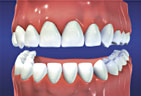 Teeth Image